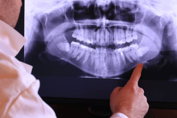 Best Emergency Denture Repair in Shoshone, ID