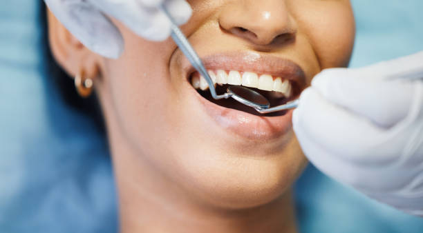 Best Emergency Wisdom Teeth Removal in Shoshone, ID