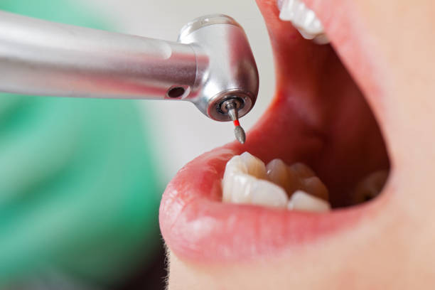 Best Emergency TMJ Treatment in Shoshone, ID